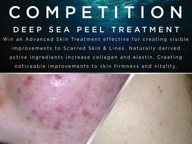 Deep Sea Peel Competition!