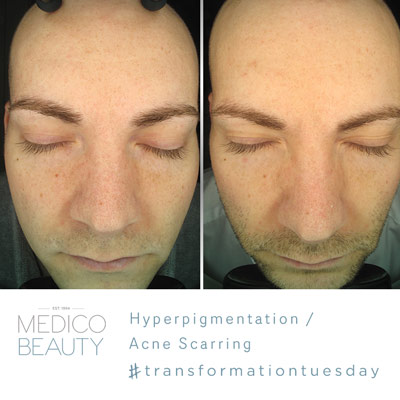 Transformation Tuesday – Andy